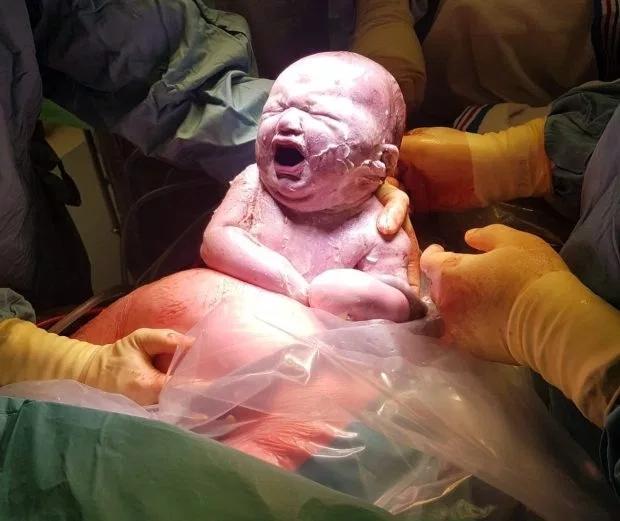 英国一女子诞下"奇迹婴儿"羊膜囊宝宝,吓坏自己以为生