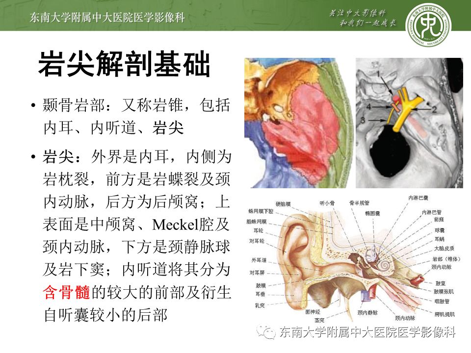 病例结果:颞骨岩尖部病变编辑/校对:郑孝飞平扫mr女,66岁,因"头晕2月