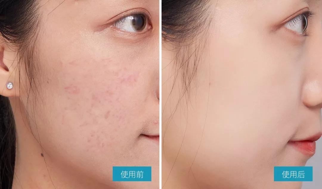 446fda6ace934a40b0e7a2a1138058d5.JPG