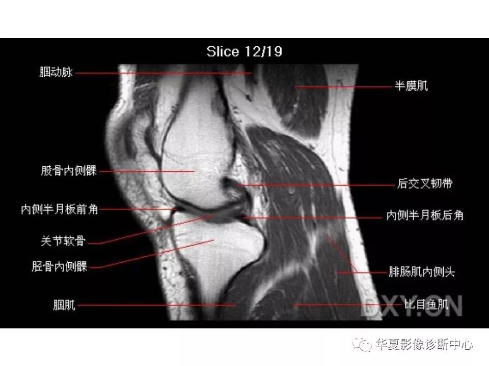 详细的膝关节mri解剖标识