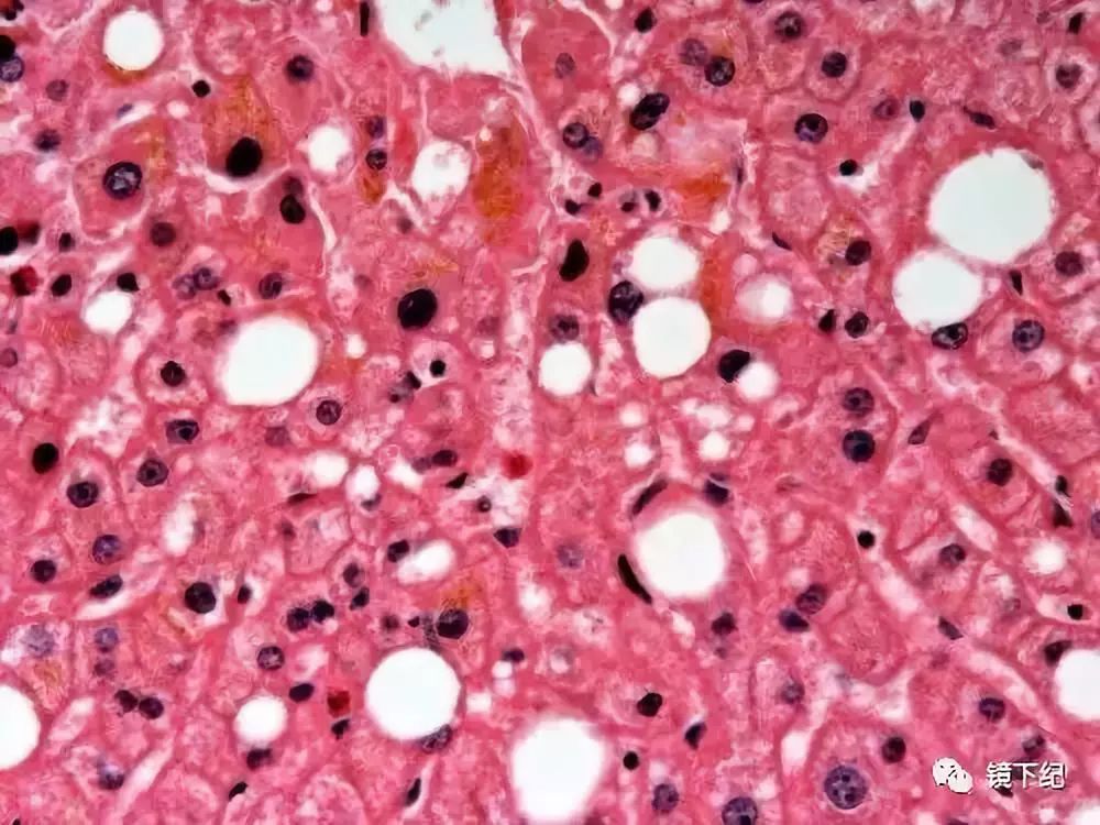 直径小至1～3μm,位于肝细胞浆无结构区域,胞核居中