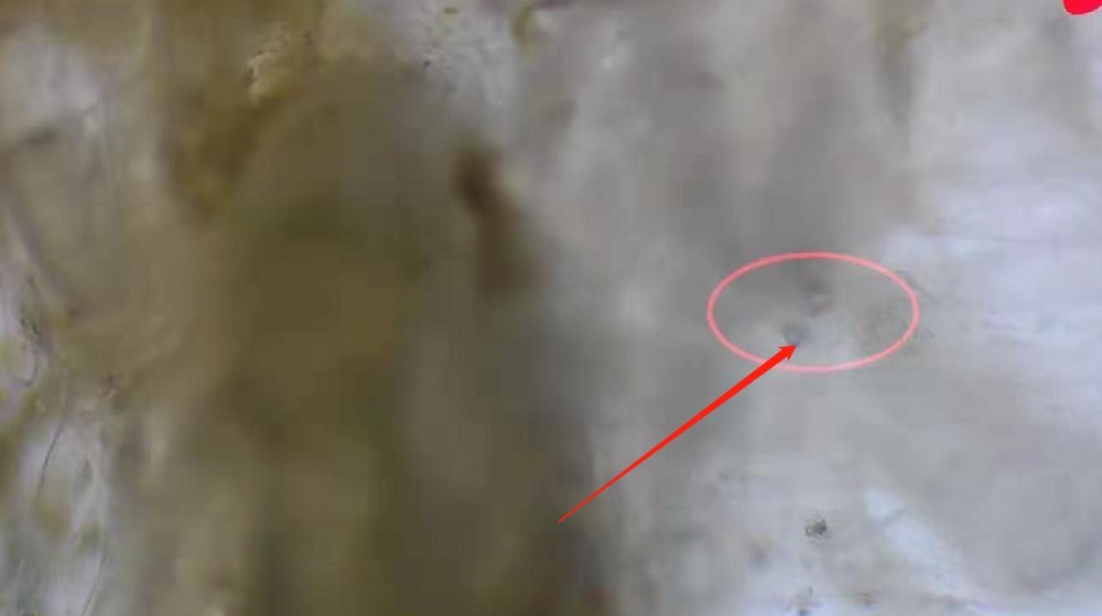 如何杀死寄生虫 c05b9140a0be4712bf0ab67fb4c81306.jpeg