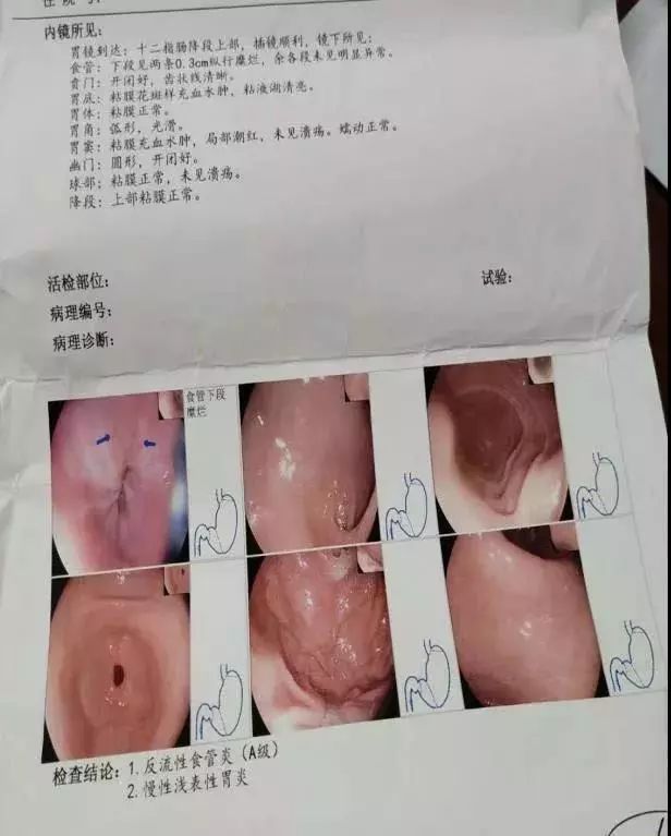 什么时候可以做胃镜 d266b6d6f7db49668d1c2f9680f3048c.jpeg