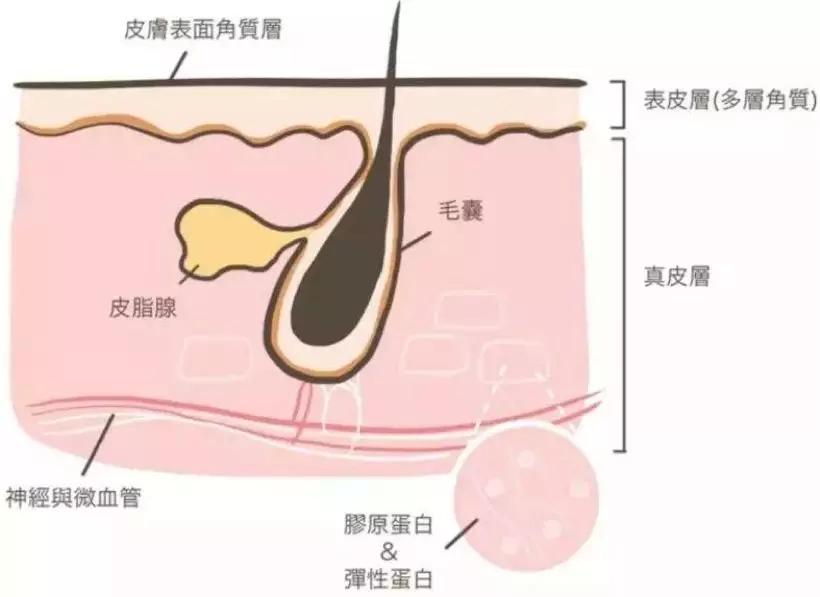 毛孔,一个痘痘的结构图:毛囊皮脂腺导管是一个管道,到达皮肤表面反应