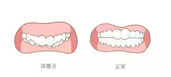 成都正畸医生黄婷婷讲：牙齿不整齐！影响的不仅仅只是你的颜值，还有这些问题！