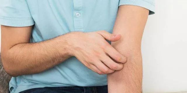 身上瘙痒是糖尿病的表现吗 ac986777f0eb4f1dae237107cc5a713f.jpeg