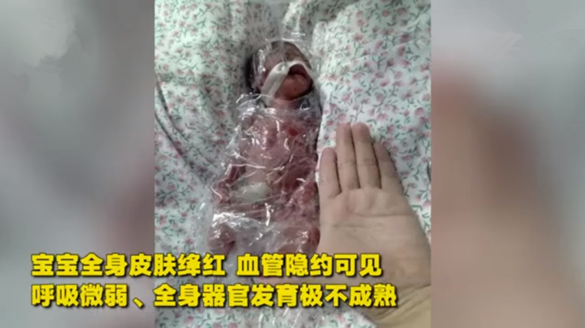 2,注意事项
