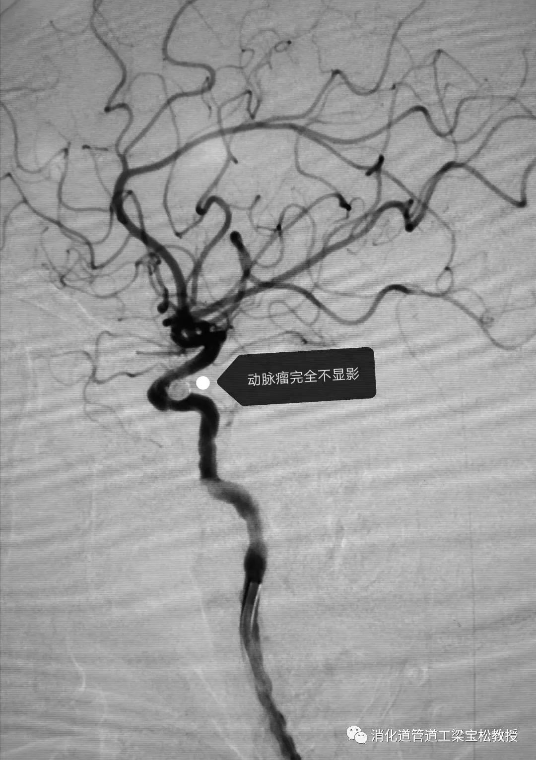 医学gdp是什么_马的标志是什么车