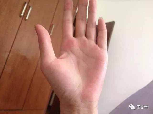 什么时候不能艾灸肚子 f7a5c502bbee4152a64c42581917ed08.jpeg