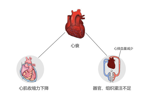 判断心衰的指标