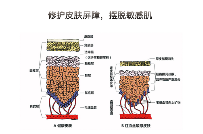 西西护肤老师:激素脸护理用冷水敷脸有效果吗?