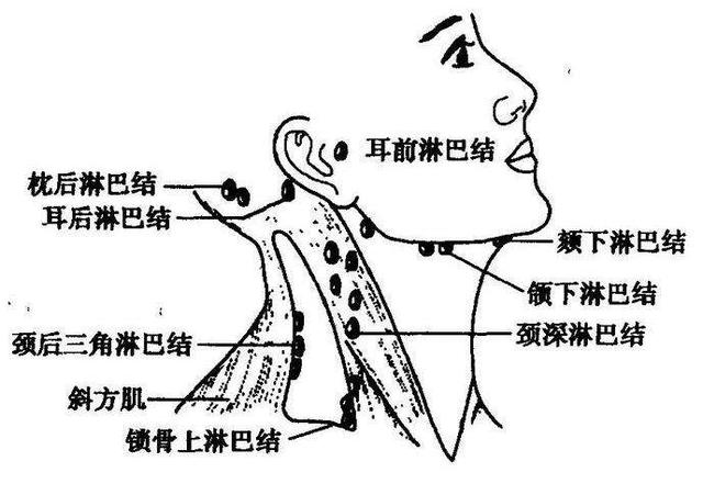 孩子反复肚子痛,不一定就是肠系膜淋巴结炎