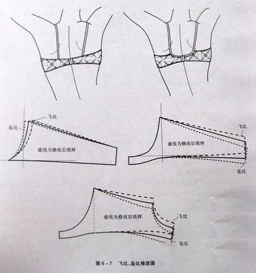 内衣侧骨_跟骨侧位x线解剖图(2)