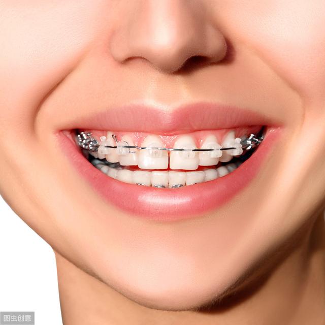 儿童矫正牙齿几岁合适?