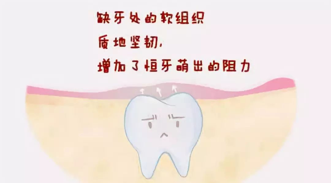 阑尾炎是怎么得的什么原因造成的 ff0ae24f6a0d4445b5ddcb9561dd3a0d.jpeg