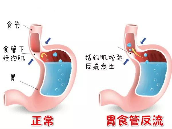 成语三什么症状_成语故事简笔画(3)