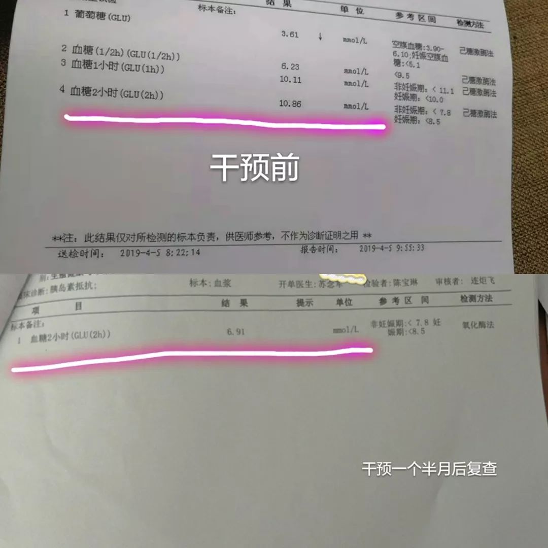 1公斤,目前维持在50-51kg上下,血糖,胰岛素,雄烯二酮等激素水平都降