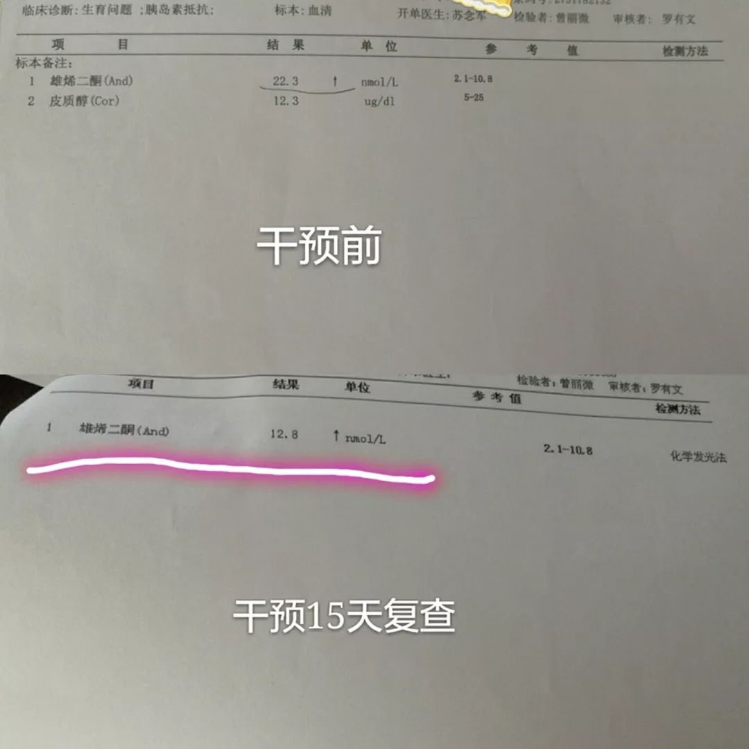 1公斤,目前维持在50-51kg上下,血糖,胰岛素,雄烯二酮等激素水平都降