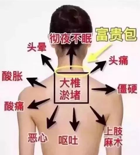 981f08a711d94fa9ac8f4e08491bd407.jpeg