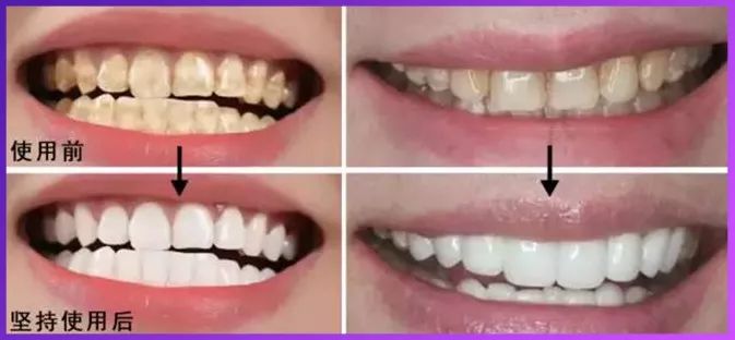 一般多久洗一次牙 cf776b7025814489aa8541c575e5517f.jpeg