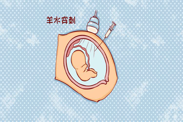 羊水穿刺什么时候做 羊水穿刺一定要做吗