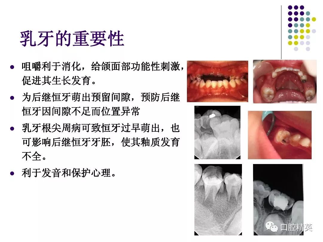 乳牙牙髓根尖周病的特点及治疗