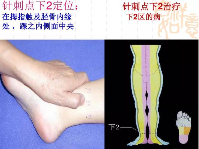 腕踝针疗法的应用