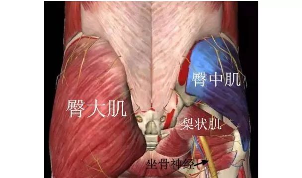 坐骨神经痛针刀治疗效果好