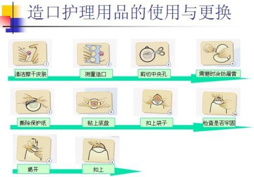 【护健图文】"造口人"术后该如何生活?