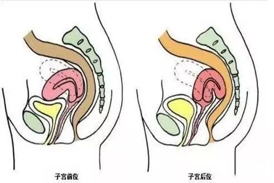 如果在子宫后壁,孕妈相对显怀的时间就会晚一些.