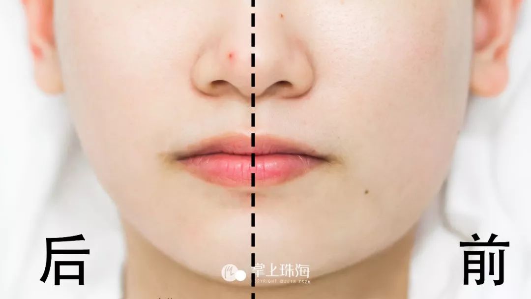 几个月会出现水肿怎么缓解 8f7fd3eb55144a42a1b0b7cde184059c.jpeg