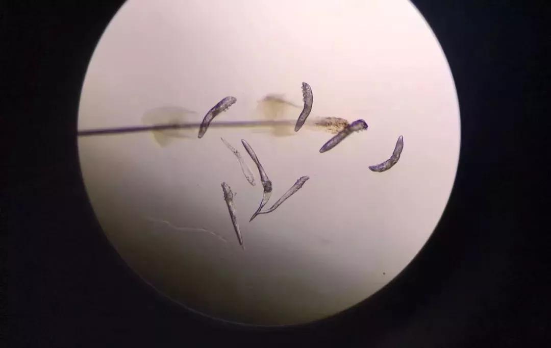 吓人睫毛上竟住着9只螨虫原因一定没想到