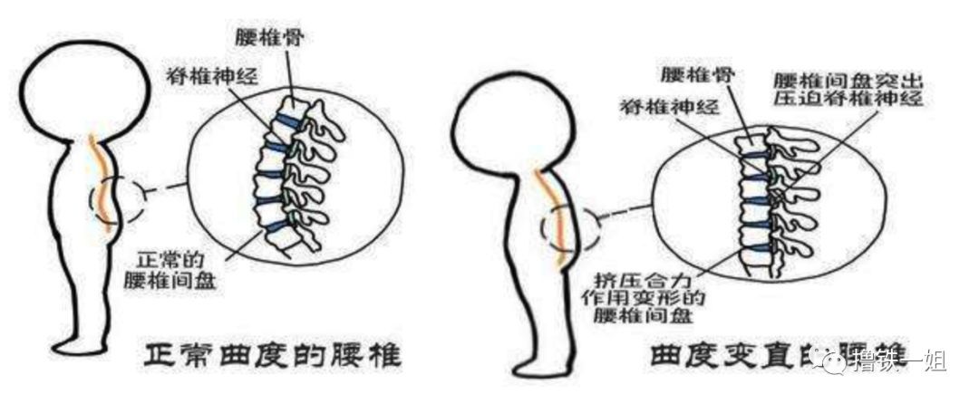 > 爆料站 > 八卦娱乐  我们正常的腰部是有生理弯曲,一旦腰部出现问题