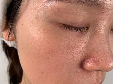 和空气长期接触之后氧化变质,让皮肤看起来暗沉没光泽.