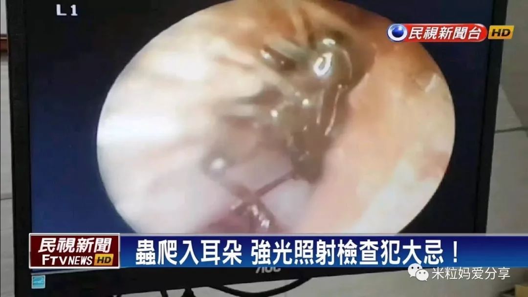 米粒妈频道■原创3岁孩子差点失聪，这个错误千万不要再犯了！