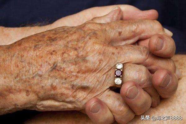 啥是老年斑 34d7595d31dd4b58976db9e0ec5da649.jpeg