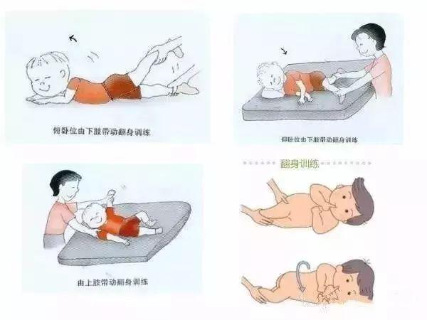 脑瘫总人口_脑瘫儿图片