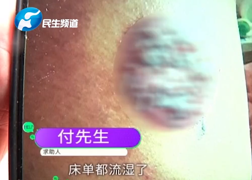 拔罐为什么不能拔中间 6f381b2611eb461789a1660e9cf3a922.png