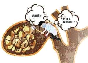 如何判断自己是否有心绞痛 784c407a1781475b89b667e6485c03c5.jpeg