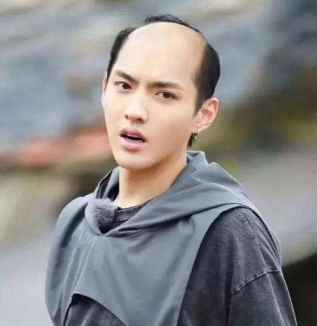前额头发少,怎么办?_发型