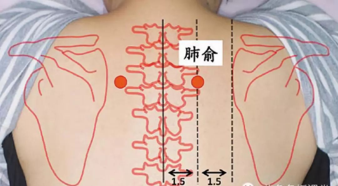 第三椎骨的位置 fc118c67b5cd4f9f9e35e1387c659b17.jpeg