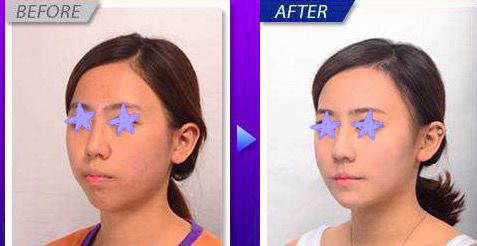 口腔颌面外科排名_口腔颌面外科(2)