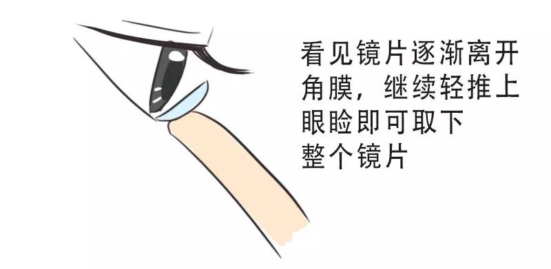 镜片松了怎么办