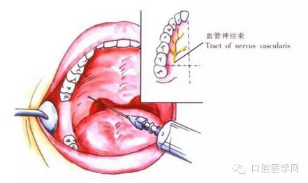 口腔颌面外科常用麻醉方法图谱