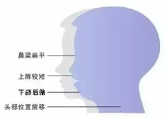 「肥猪嘟嘟」孩子有三次改变牙齿不齐的黄金期，爸妈千万别错过！