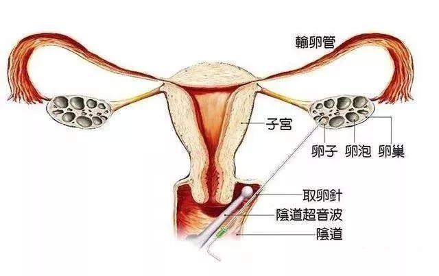 什么取卵成语_成语故事简笔画(2)