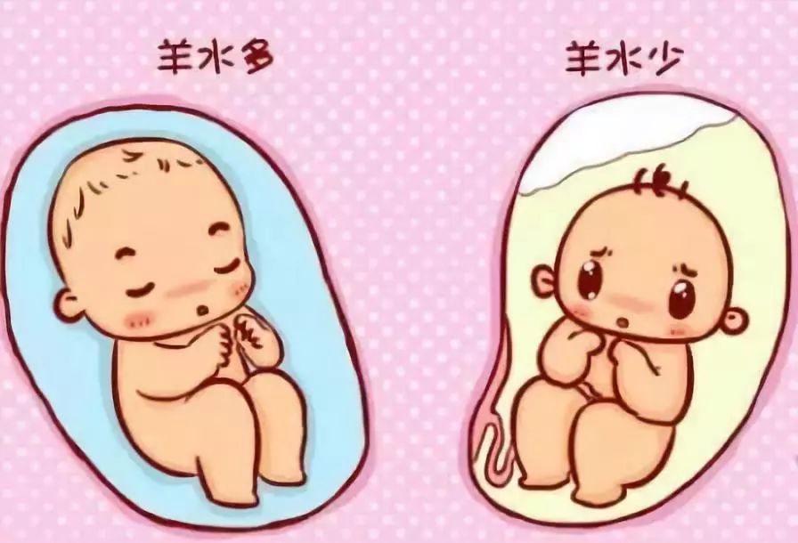 羊水过多过少都有危害每位孕妈都要重视起来