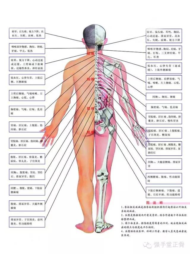 骨盆移位会引起脊柱侧弯还会引起什么?_胸椎