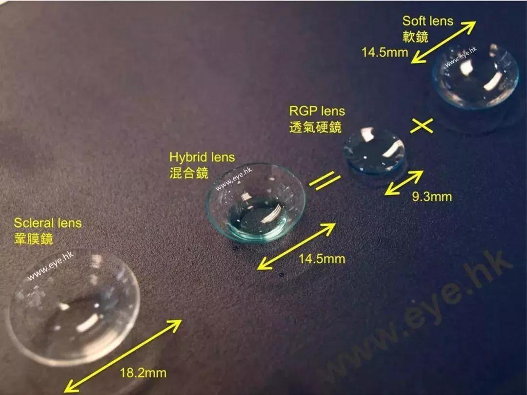 因此我们常常在验配角膜塑形镜时会更多地使用placido环原理的角膜