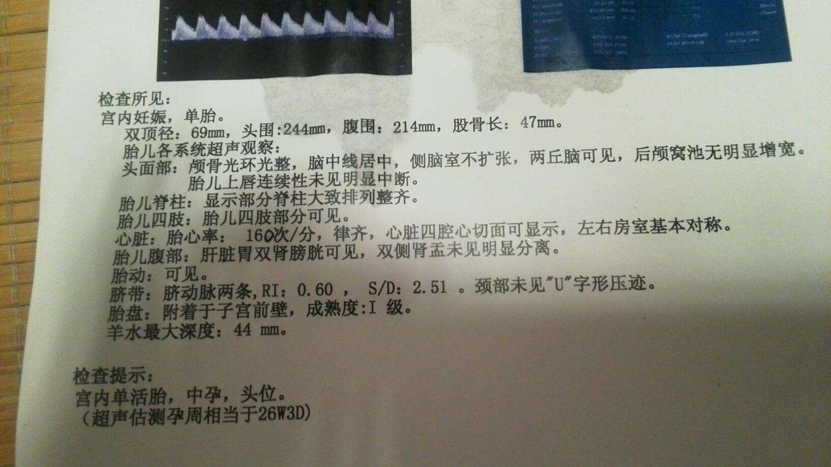 #挚爱宝宝一生#孕妇营养不良对胎儿的影响太可怕了 ，看看你都有哪些点？需谨慎了